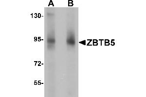 Western Blotting (WB) image for anti-Zinc Finger and BTB Domain Containing 5 (ZBTB5) (C-Term) antibody (ABIN1030813) (ZBTB5 antibody  (C-Term))