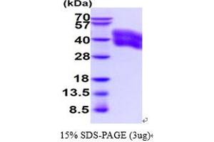 SDS-PAGE (SDS) image for Carcinoembryonic Antigen-Related Cell Adhesion Molecule 6 (CEACAM6) (AA 35-320) protein (His tag) (ABIN5854615)