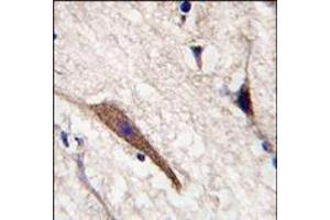 Image no. 2 for anti-P21 Protein (Cdc42/Rac)-Activated Kinase 7 (PAK7) (AA 183-198) antibody (ABIN360325)