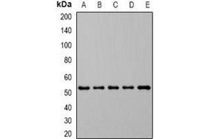 Western blot analysis of DHODH expression in MCF7 (A), HL60 (B), SW620 (C), mouse spleen (D), rat kidney (E) whole cell lysates. (DHODH antibody)