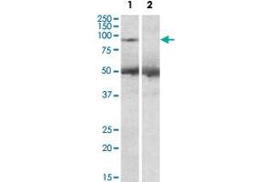 USP6 polyclonal antibody (2 ug/mL) staining of human placenta lysate (35 ug protein in RIPA buffer) with (lane 2) and without (lane 1) blocking with the immunizing peptide. (USP6 antibody  (C-Term))