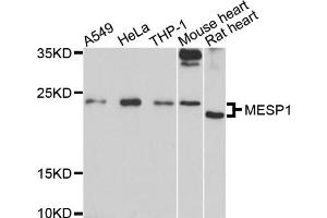 Western blot analysis of extracts of various cell lines, using MESP1 antibody (ABIN6003846) at 1/1000 dilution.