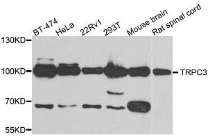 Western blot analysis of extracts of various cell lines, using TRPC3 antibody. (TRPC3 antibody)