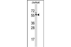 Western blot analysis in Jurkat cell line lysates (35ug/lane). (G3BP1 antibody  (C-Term))