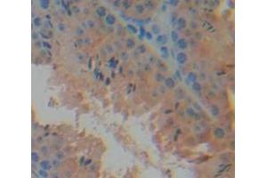 Figure. (Mucosae Associated Epithelia Chemokine (AA 17-130) antibody)