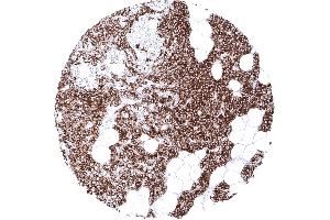 Parathyroid Strong cytoplasmic PTH immunostaining of all cells of a parathyroid gland (Recombinant PTH antibody  (AA 1-34))