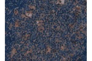 IHC-P analysis of Mouse Lymph node Tissue, with DAB staining.