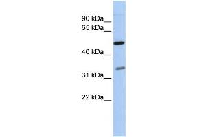 Western Blotting (WB) image for anti-Polyglutamine Binding Protein 1 (PQBP1) antibody (ABIN2457939) (PQBP1 antibody)