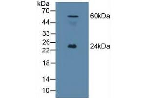 Figure 1. (Ephrin A1 antibody  (AA 19-182))