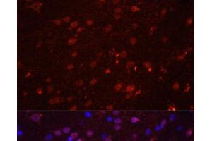 Immunofluorescence analysis of Rat brain using GRIN2B Polyclonal Antibody at dilution of 1:100. (GRIN2B antibody)
