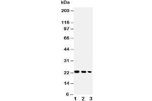Western Blotting (WB) image for anti-Tumor Necrosis Factor (Ligand) Superfamily, Member 13b (TNFSF13B) (AA 265-285) antibody (ABIN3029356)
