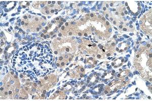 Human kidney (FKBP6 antibody  (Middle Region))