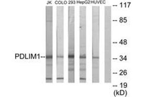 Western blot analysis of extracts from Jurkat/COLO205/293/HepG2/HuvEc cells, using PDLIM1 Antibody. (PDLIM1 antibody  (AA 61-110))