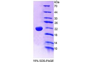 SDS-PAGE (SDS) image for Protein tyrosine Phosphatase, Non-Receptor Type 13 (APO-1/CD95 (Fas)-Associated Phosphatase) (PTPN13) (AA 1-161) protein (His tag) (ABIN4989871)