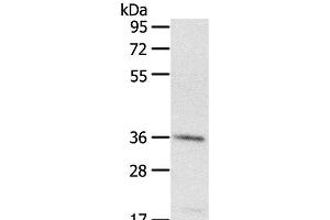 Western Blot analysis of A431 cell using PDLIM4 Polyclonal Antibody at dilution of 1:400