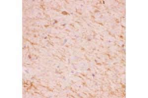 Immunohistochemistry (IHC) image for anti-Sirtuin 2 (SIRT2) (AA 165-187), (Middle Region) antibody (ABIN3043924)