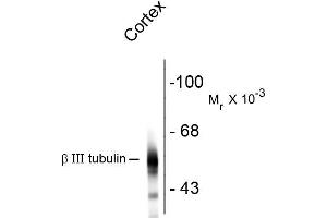 Western blots of rat cortex lysate showing specific immunolabeling of the ~55k beta III tubulin protein. (TUBB3 antibody)