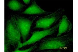 Immunofluorescence of purified MaxPab antibody to PSME1 on HeLa cell. (PSME1 antibody  (AA 1-249))