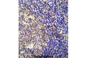 YDJC Antibody (Center) immunohistochemistry analysis in formalin fixed and paraffin embedded human tonsil tissue followed by peroxidase conjugation of the secondary antibody and DAB staining. (YdjC antibody  (Middle Region))