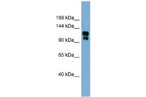WB Suggested Anti-TRPA1 Antibody Titration:  0. (TRPA1 antibody  (Middle Region))