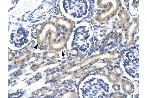 TRAFD1 antibody was used for immunohistochemistry at a concentration of 4-8 ug/ml to stain Epithelial cells of renal tubule (lndicated with Arrows] in Human Kidney.