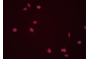 ABIN6274008 staining Hela cells by IF/ICC. (DUSP6 antibody  (Internal Region))