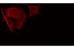 ABIN6274835 staining HeLa cells by IF/ICC. (SGCA antibody  (Internal Region))