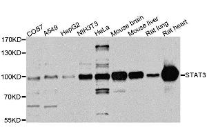 Western blot analysis of extracts of various cell lines, using STAT3 antibody. (STAT3 antibody  (AA 640-770))