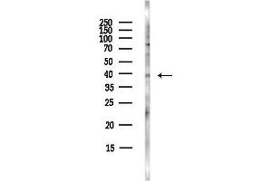 anti-Cannabinoid Receptor 2 (CNR2) (C-Term) antibody