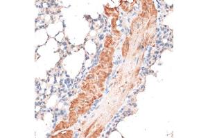 Immunohistochemistry of paraffin-embedded mouse lung using ABCB7 antibody. (ABCB7 antibody)