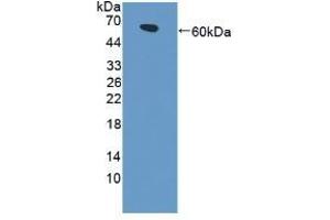 Detection of Recombinant LRP4, Human using Polyclonal Antibody to Low Density Lipoprotein Receptor Related Protein 4 (LRP4) (LRP4 antibody  (AA 1610-1885))