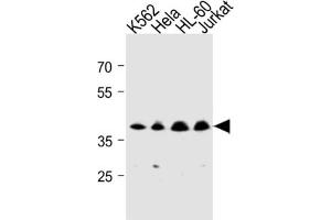 Western Blotting (WB) image for anti-Mitochondrial Trans-2-Enoyl-CoA Reductase (MECR) antibody (ABIN3004507)