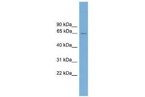 CARD9 antibody used at 0. (CARD9 antibody  (Middle Region))