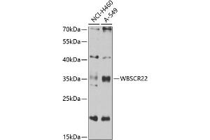Western blot analysis of extracts of various cell lines, using WBSCR22 antibody (ABIN6132946, ABIN6150175, ABIN6150176 and ABIN6223157) at 1:1000 dilution. (WBSCR22 antibody  (AA 1-281))