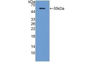 Detection of Recombinant ADP, Porcine using Polyclonal Antibody to Adiponectin (ADPN) (ADIPOQ antibody  (AA 17-243))