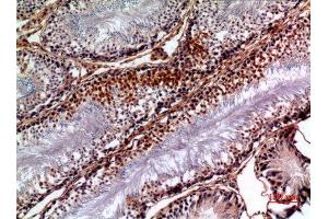 Immunohistochemistry (IHC) analysis of paraffin-embedded Rat Testis, antibody was diluted at 1:100. (PNPLA6 antibody  (Internal Region))