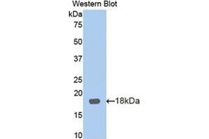 Figure. (Periostin antibody  (Biotin))