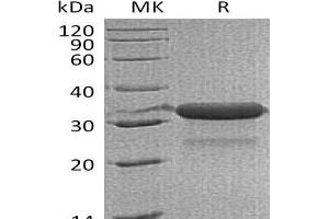 Insulin-Like Growth Factor Binding Protein 7 (IGFBP7) protein (His tag)