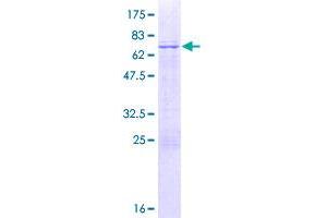 MAGEB18 Protein (AA 1-343) (GST tag)