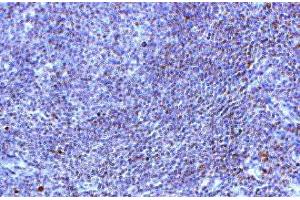 Image no. 1 for anti-Toll-Like Receptor 10 (TLR10) (AA 81-111) antibody (ABIN342786) (TLR10 antibody  (AA 81-111))