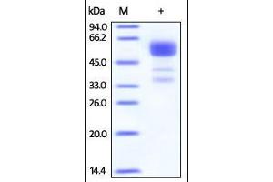 Human 4-1BB, Fc Tag on SDS-PAGE under reducing (R) condition. (CD137 Protein (AA 24-186) (Fc Tag))