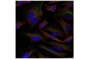 Image no. 2 for anti-Adducin 1 (Alpha) (ADD1) (Ser726) antibody (ABIN197406) (alpha Adducin antibody  (Ser726))