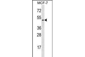 LAD1 Antibody (N-term) (ABIN656787 and ABIN2846006) western blot analysis in MCF-7 cell line lysates (35 μg/lane). (Ladinin 1 antibody  (N-Term))