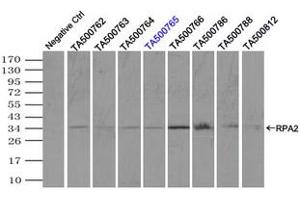 Image no. 10 for anti-Replication Protein A2, 32kDa (RPA2) antibody (ABIN1500735)