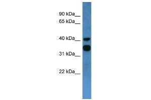 WB Suggested Anti-F2RL2 Antibody Titration: 0. (F2RL2 antibody  (C-Term))