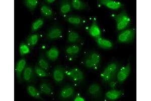 Immunofluorescence analysis of MCF7 cells using DR1 Polyclonal Antibody (DR1 antibody)