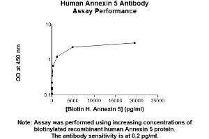 Image no. 2 for anti-Annexin A5 (ANXA5) (AA 1-320) antibody (ABIN5564834) (Annexin V antibody  (AA 1-320))