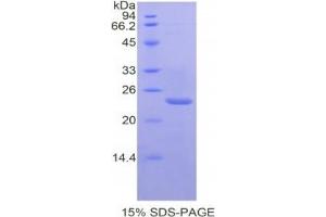 SDS-PAGE analysis of Mouse PTGS1 Protein. (PTGS1 Protein)