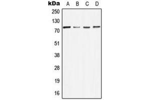 Western blot analysis of MELK expression in MCF7 (A), NIH3T3 (B), mouse liver (C), rat liver (D) whole cell lysates. (MELK antibody  (Center))