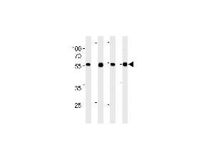 TPIPb Antibody (C-term) ABIN1882284 western blot analysis in 293,A431,,mouse NIH/3T3 cell line lysates (35 μg/lane). (TPTE2 antibody)
